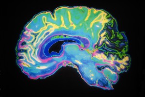 MRI Scan Of Human Brain